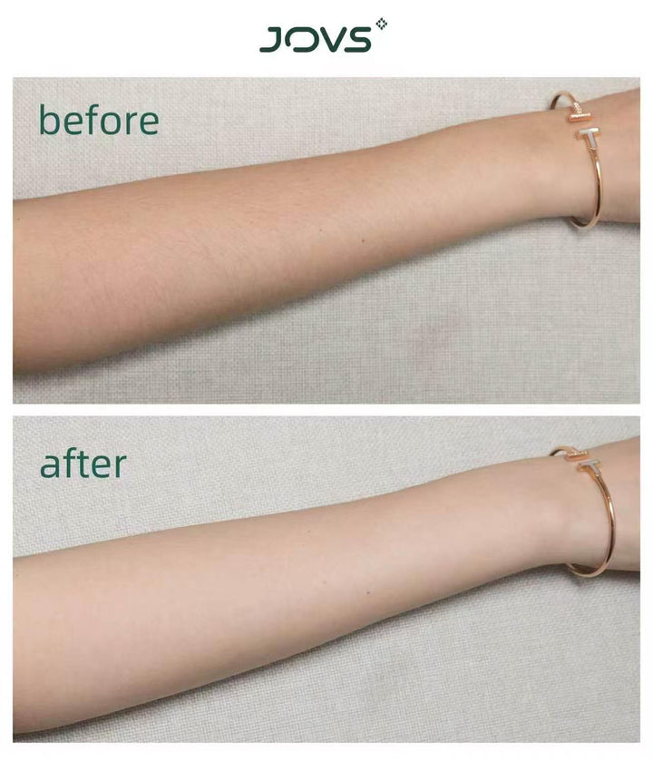 JOVS Venus Pro™ IPL(Intense Pulsed Light) Hair Remover